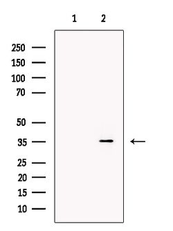 Invitrogen DARC Polyclonal Antibody 100 μL; Unconjugated:Antibodies,