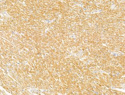 Invitrogen DBT Polyclonal Antibody 100 &mu;L | Buy Online | Invitrogen&trade; | Fisher Scientific