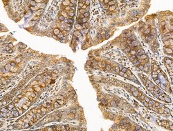 Invitrogen DBT Polyclonal Antibody 100 &mu;L | Buy Online | Invitrogen&trade; | Fisher Scientific