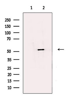 Invitrogen DBT Polyclonal Antibody 100 &mu;L | Buy Online | Invitrogen&trade; | Fisher Scientific