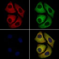 Invitrogen DCC Polyclonal Antibody 100 &mu;L; Unconjugated:Antibodies,