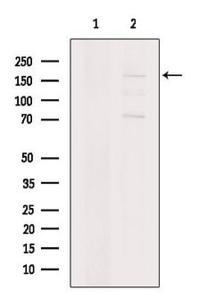 Invitrogen DCC Polyclonal Antibody 100 &mu;L; Unconjugated:Antibodies,
