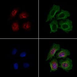 Invitrogen DCP2 Polyclonal Antibody 100 μL; Unconjugated:Antibodies,