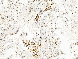 Invitrogen DCP2 Polyclonal Antibody 100 μL; Unconjugated:Antibodies,
