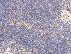 Invitrogen DCP2 Polyclonal Antibody 100 μL; Unconjugated:Antibodies,