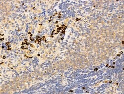 Invitrogen DCP2 Polyclonal Antibody 100 μL; Unconjugated:Antibodies,