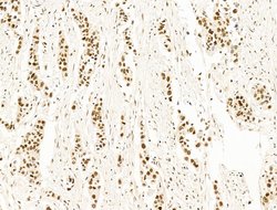 Invitrogen DCP2 Polyclonal Antibody 100 μL; Unconjugated:Antibodies,