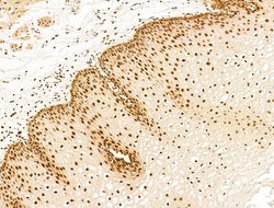 Invitrogen DCP2 Polyclonal Antibody 100 μL; Unconjugated:Antibodies,