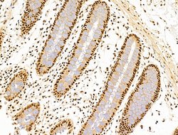 Invitrogen DCP2 Polyclonal Antibody 100 μL; Unconjugated:Antibodies,