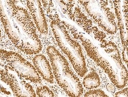 Invitrogen DCP2 Polyclonal Antibody 100 μL; Unconjugated:Antibodies,
