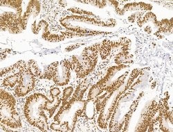 Invitrogen DCP2 Polyclonal Antibody 100 μL; Unconjugated:Antibodies,