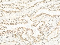 Invitrogen DCP2 Polyclonal Antibody 100 μL; Unconjugated:Antibodies,
