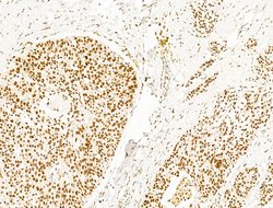 Invitrogen DCP2 Polyclonal Antibody 100 μL; Unconjugated:Antibodies,