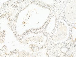 Invitrogen DCP2 Polyclonal Antibody 100 μL; Unconjugated:Antibodies,