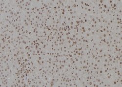 Invitrogen DDB1 Polyclonal Antibody 100 &mu;L; Unconjugated:Antibodies,