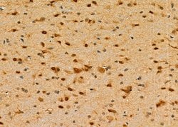 Invitrogen DDB1 Polyclonal Antibody 100 &mu;L; Unconjugated:Antibodies,