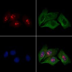 Invitrogen DDX18 Polyclonal Antibody 100 &mu;L; Unconjugated:Antibodies,