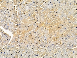 Invitrogen Dectin 1 Polyclonal Antibody 100 &mu;L; Unconjugated:Antibodies,