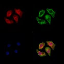 Invitrogen Dectin 1 Polyclonal Antibody 100 &mu;L; Unconjugated:Antibodies,