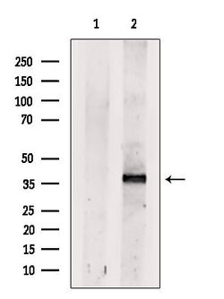 Invitrogen Dectin 1 Polyclonal Antibody 100 &mu;L; Unconjugated:Antibodies,