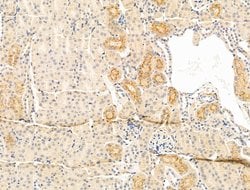Invitrogen DERL2 Polyclonal Antibody 100 &mu;L; Unconjugated:Antibodies,