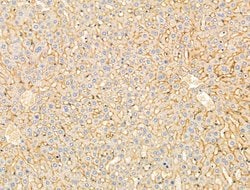 Invitrogen DERL2 Polyclonal Antibody 100 &mu;L; Unconjugated:Antibodies,