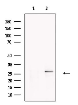 Invitrogen DERL2 Polyclonal Antibody 100 &mu;L; Unconjugated:Antibodies,