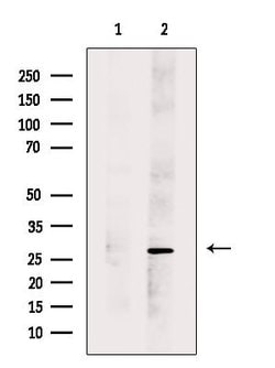 Invitrogen DERL2 Polyclonal Antibody 100 &mu;L; Unconjugated:Antibodies,