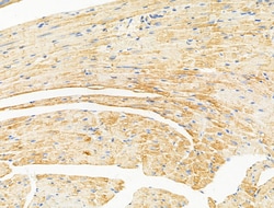 Invitrogen Desmin Polyclonal Antibody 100 &mu;L; Unconjugated:Antibodies,