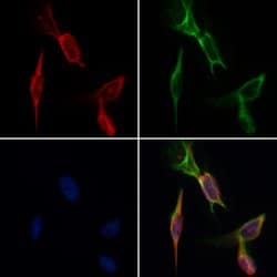 Invitrogen Desmin Polyclonal Antibody 100 &mu;L; Unconjugated:Antibodies,