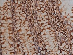Invitrogen Desmin Polyclonal Antibody 100 &mu;L; Unconjugated:Antibodies,