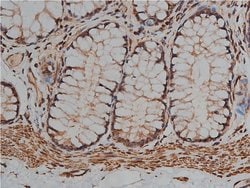 Invitrogen Desmin Polyclonal Antibody 100 &mu;L; Unconjugated:Antibodies,