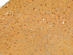Invitrogen Desmin Polyclonal Antibody 100 &mu;L; Unconjugated:Antibodies,