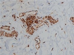 Invitrogen Desmin Polyclonal Antibody 100 &mu;L; Unconjugated:Antibodies,