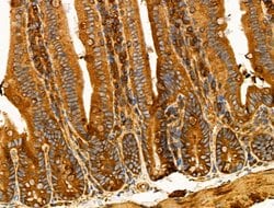 Invitrogen Desmin Polyclonal Antibody 100 &mu;L; Unconjugated:Antibodies,