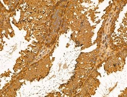 Invitrogen Desmin Polyclonal Antibody 100 &mu;L; Unconjugated:Antibodies,