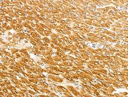 Invitrogen Desmin Polyclonal Antibody 100 &mu;L; Unconjugated:Antibodies,