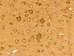 Invitrogen Desmin Polyclonal Antibody 100 &mu;L; Unconjugated:Antibodies,