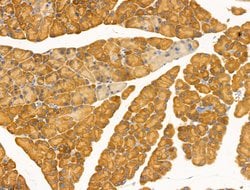 Invitrogen Desmin Polyclonal Antibody 100 &mu;L; Unconjugated:Antibodies,