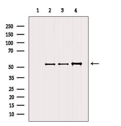 Invitrogen Desmin Polyclonal Antibody 100 &mu;L; Unconjugated:Antibodies,