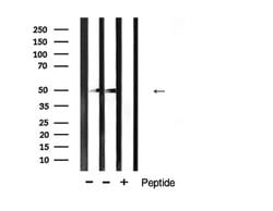 Invitrogen Desmin Polyclonal Antibody 100 &mu;L; Unconjugated:Antibodies,