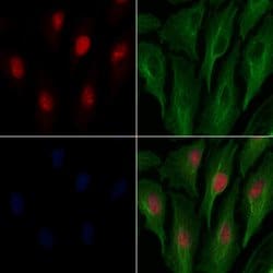 Invitrogen DFFB Polyclonal Antibody 100 &mu;L | Buy Online | Invitrogen&trade; | Fisher Scientific
