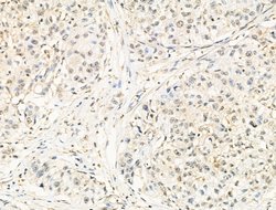 Invitrogen DFFB Polyclonal Antibody 100 &mu;L | Buy Online | Invitrogen&trade; | Fisher Scientific
