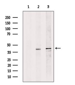 Invitrogen DFFB Polyclonal Antibody 100 &mu;L | Buy Online | Invitrogen&trade; | Fisher Scientific