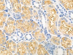 DGAT1 Polyclonal Antibody:Antibodies, Polyclonal