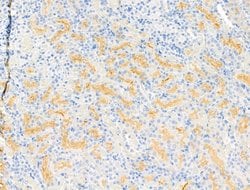 DGAT1 Polyclonal Antibody:Antibodies, Polyclonal