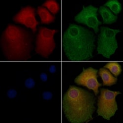 Invitrogen DHFR Polyclonal Antibody 100 &mu;L; Unconjugated:Antibodies,