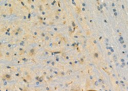 Invitrogen DHFR Polyclonal Antibody 100 &mu;L; Unconjugated:Antibodies,