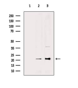 Invitrogen DHFR Polyclonal Antibody 100 &mu;L; Unconjugated:Antibodies,