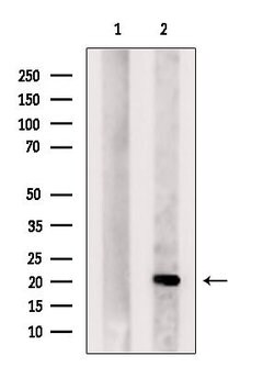 Invitrogen DHFR Polyclonal Antibody 100 &mu;L; Unconjugated:Antibodies,